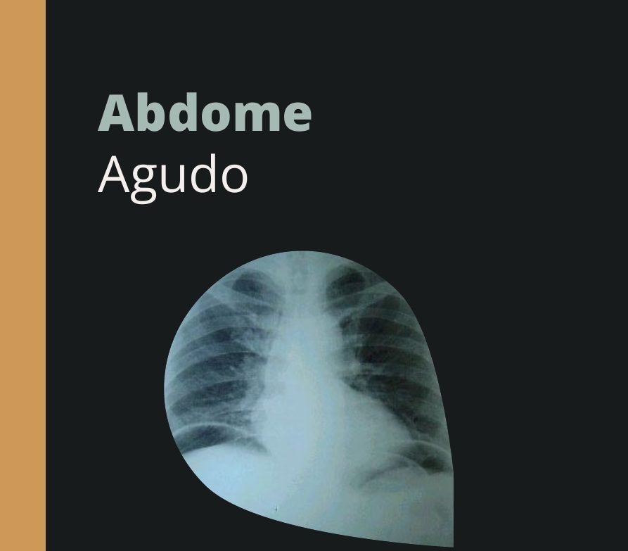 Capa do eBook Abdome Agudo