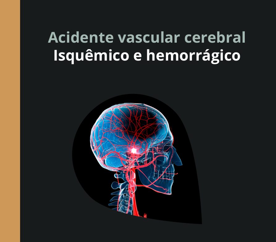 Capa do eBook AVC isquêmico e hemorrágico