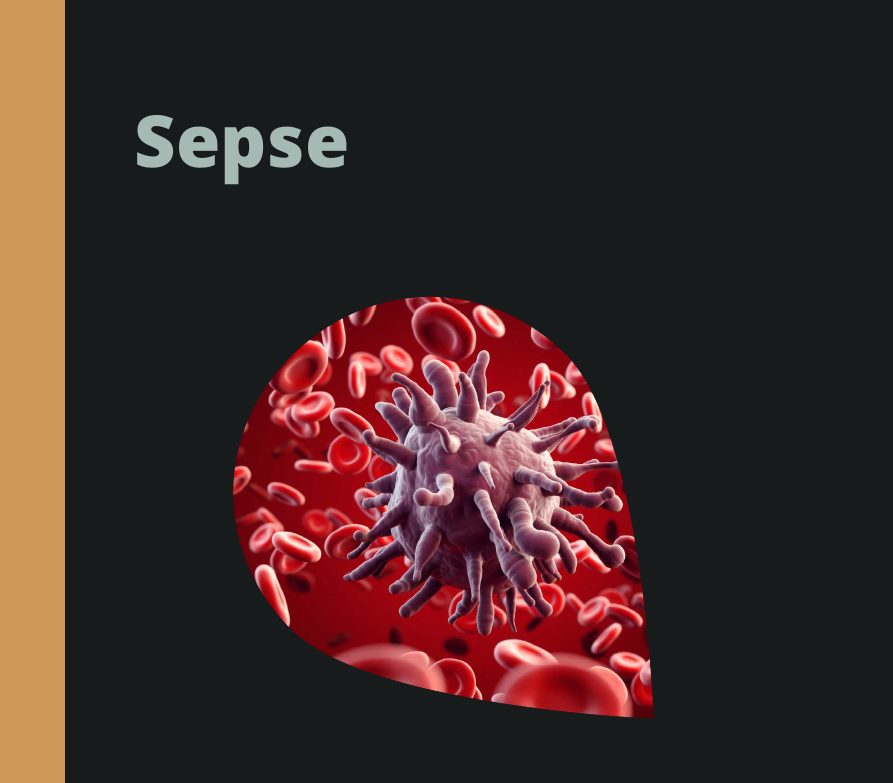 Capa do eBook Sepse